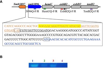 HemU and TonB1 contribute to hemin acquisition in Stenotrophomonas maltophilia